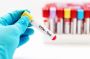 Home STD Testing Kit Dubai – How It Works