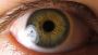 Stem Cell Therapy for Eyes