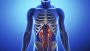 Stem Cell Transplant for Kidney Disease