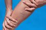 What Type of Doctor Treats Varicose Veins?