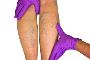 What do Vein Centers do?