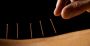 Comprehensive Acupuncture in Dupont Circle, DC for Wellness