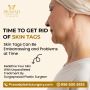 Skin Tag Removal Treatment in Visakhapatnam