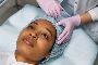 Best Botox treatment in Chennai 