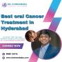Best oral Cancer treatment in Hyderabad