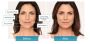 Skin Tightening In Maple Ave E