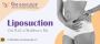Liposuction: How it works, Types, Safety & Benefits