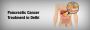 Best Pancreatic Cancer Treatment in Delhi - Dr. Asit Arora