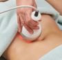 Exilis Treatment in Delhi at AKARA by AAYNA