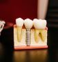 Best Dental Clinic in Kolkata – Advanced Oral Care  