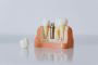 Top Dental Implant Clinic in Newtown – Trusted Specialists