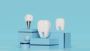 Affordable Dental Implant Clinic in Newtown