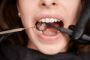 Root Canal Treatment in Newtown by Expert Dentist