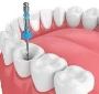 Painless Root Canal Treatment in Newtown  