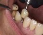Holistic dentist in Mexico
