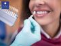 Achieve a Radiant Smile with Local Teeth Whitening Services 