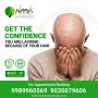 hair patches in hyderabad