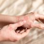 Texas Allergy Group PLLC Texas Allergy Group PLLC