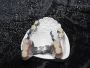Order Custom Chrome Cobalt Partial Dentures at Factory Price