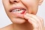 Periodontics specialist in Noida