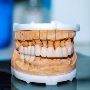 Full Mouth Rehabilitation in Noida Sector 112