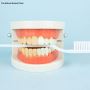Teeth Whitening Treatment in Noida