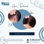Best Non Surgical Hair Replacement in Bhubaneswar