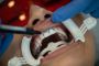 Need immediate Harley Street teeth bonding? 