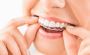 Get to Know About the Best Orthodontics Dentist Boronia