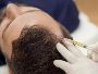 PRP Treatment in Lucknow