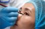 Eye Bag Removal in London, UK