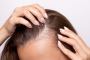 Dallas Hair Loss Solutions