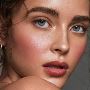 Rosacea Laser Treatment Toronto - Tight Clinic