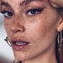 Restore Your Skin With Sun Damage Treatment Toronto