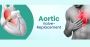 Affordable Aortic Valve Replacement Cost in India – Everythi