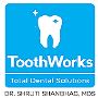 Full mouth dental implants