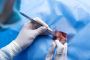 How is Benign Bone Tumor Removal treated?