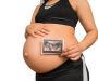 See Your Baby With A 6 Week Ultrasound at Tummy Vision