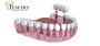 Dentist Rajpura