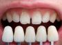Best Dental Clinic in Jivraj Park