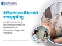Top Diagnostic Centre in Indore for Fibroids