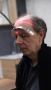 Best Sapphire FUE Hair Transplant in Turkey