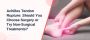 Achilles Tendon Rupture: Should You Choose Surgery or Try No