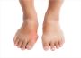 Urgent Care for Gout Treatment | Urgent Foot Care