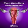 Fibroid Removal Made Easy with USA Fibroid Centers