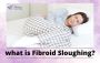 What is Fibroid Sloughing?