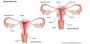 Seeking Help for Enlarged Uterus Symptoms Near You