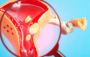 Can Fibroids Burst? Know the Risks & Symptoms