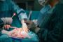 The Truth About Hysterectomy for Fibroids: A Guide for Women