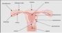 Fibroid Specialist Near Me in Richardson, Dallas – USA